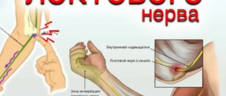 Causes of ulnar nerve neuropathy