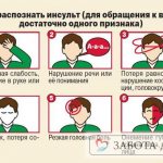 Признаки инсульта