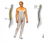 Симптомы гемиплегии