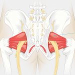 piriformis syndrome