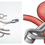 Vascular clips