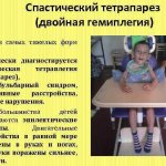 Спастический тетрапарез у детей. Что это такое, причины и лечение