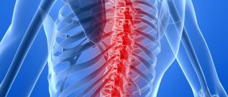 Spinal stroke. Aksimed.ua.