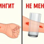 meningococcal rash test.jpg