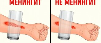 тест на менингококковую сыпь.jpg