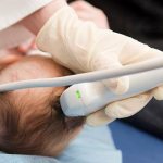 TCD of cerebral vessels where to do