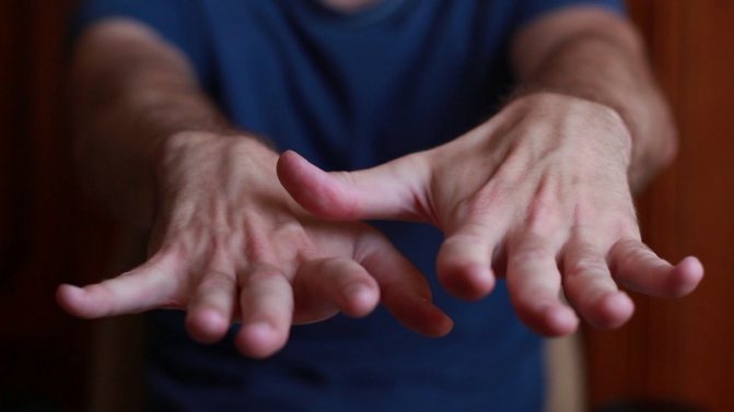 Тремор рук: причины у взрослых, медикаментозное лечение тремора в ...