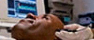 Vertebrobasilar insufficiency (VBI) is a fairly common form of deterioration in brain function. It occurs due to a lack of blood supply to the posterior parts of the brain by vessels arising from the main and vertebral arteries.