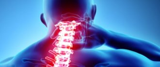 Vertebrogenic pain syndrome