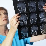 Виды гидроцефалии