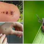 вирусный энцефалит