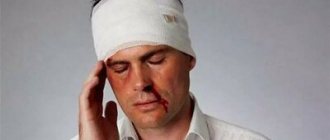 внутричерепная гематома