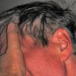 Все оттенки невроза | Иллюстрация pixabay.com