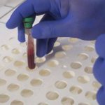 Drawing blood for creatinine testing