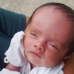 fluid in the head of a newborn